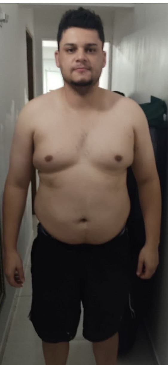 Rodolfo antes da transformação